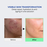 Cica Micro-Shot Infusion  Liquid Micro-Needling Serum (Patented Korean Spicule Technology)